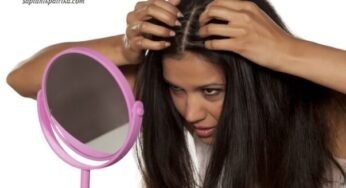 रूसी का इलाज घर पर हिंदी में (Dandruff Treatment at Home in Hindi) 
