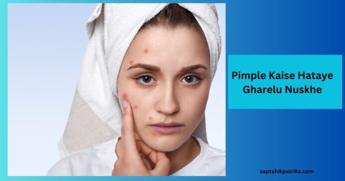 Pimple Gharelu nushkhe