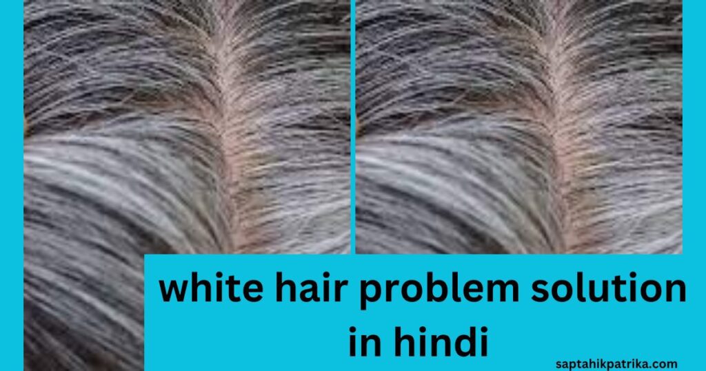 White Hair treatment