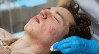 Compelling Skin break out Check Laser Treatment: Clear Skin is Fair a Treatment Absent