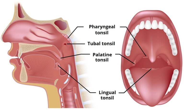 Can tonsils grow back after being removed? - tymoff